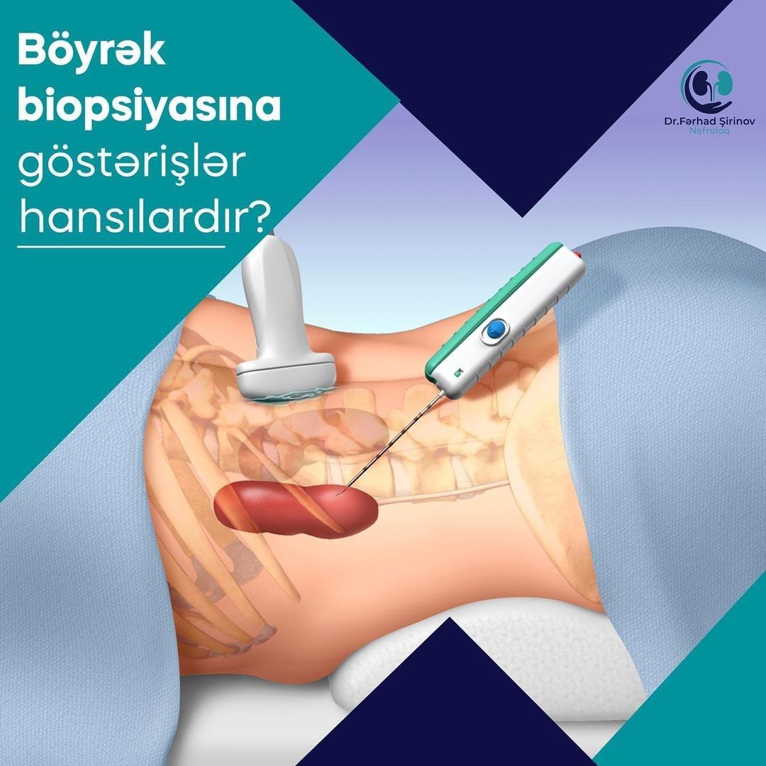 Nefroloq,&nbsp;Böyrək biopsiyası